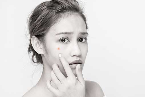 young, beautiful girl looking at her acne, worried